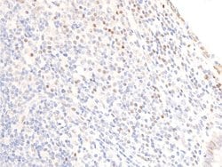Invitrogen Phospho-EGFR (Ser1071) Polyclonal Antibody 100 &mu;L; Unconjugated:Antibodies,