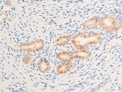 Invitrogen Phospho-EGFR (Ser1071) Polyclonal Antibody 100 &mu;L; Unconjugated:Antibodies,