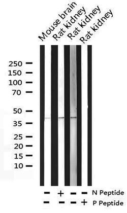 Invitrogen Phospho-c-Fos (Ser362) Polyclonal Antibody 100 &mu;L; Unconjugated:Antibodies,