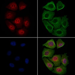 Invitrogen Phospho-c-Myc (Thr58) Polyclonal Antibody 100 &mu;L; Unconjugated:Antibodies,