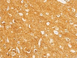 Invitrogen Phospho-c-Myc (Thr58) Polyclonal Antibody 100 &mu;L; Unconjugated:Antibodies,