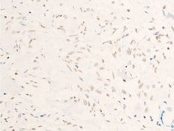 Invitrogen Phospho-c-Myc (Thr58) Polyclonal Antibody 100 &mu;L; Unconjugated:Antibodies,