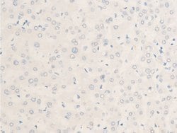 Invitrogen Phospho-c-Myc (Thr58) Polyclonal Antibody 100 &mu;L; Unconjugated:Antibodies,