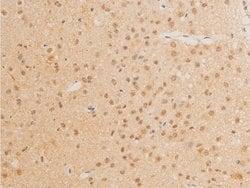 Invitrogen Phospho-c-Myc (Thr58) Polyclonal Antibody 100 &mu;L; Unconjugated:Antibodies,