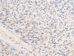 Invitrogen Phospho-c-Myc (Thr58) Polyclonal Antibody 100 &mu;L; Unconjugated:Antibodies,