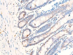 Invitrogen Phospho-c-Myc (Thr58) Polyclonal Antibody 100 &mu;L; Unconjugated:Antibodies,