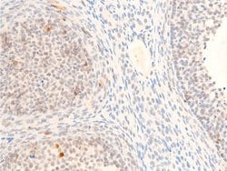 Invitrogen Phospho-c-Myc (Thr58) Polyclonal Antibody 100 &mu;L; Unconjugated:Antibodies,