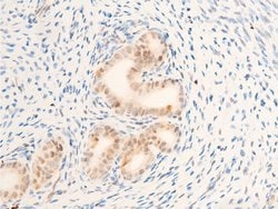 Invitrogen Phospho-c-Myc (Thr58) Polyclonal Antibody 100 &mu;L; Unconjugated:Antibodies,