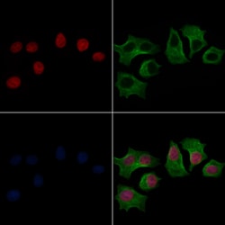 Invitrogen Phospho-Lamin A/C (Ser392) Polyclonal Antibody 100 &mu;L; Unconjugated:Antibodies,