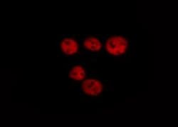 Invitrogen Phospho-Lamin A/C (Ser392) Polyclonal Antibody 100 &mu;L; Unconjugated:Antibodies,