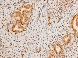 Invitrogen Phospho-Lamin A/C (Ser392) Polyclonal Antibody 100 &mu;L; Unconjugated:Antibodies,