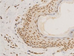 Invitrogen Phospho-Lamin A/C (Ser392) Polyclonal Antibody 100 &mu;L; Unconjugated:Antibodies,
