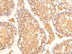 Invitrogen Phospho-Lamin A/C (Ser392) Polyclonal Antibody 100 &mu;L; Unconjugated:Antibodies,