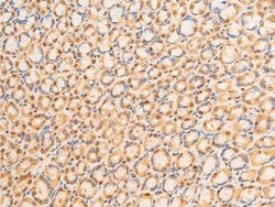 Invitrogen Phospho-Lamin A/C (Ser392) Polyclonal Antibody 100 &mu;L; Unconjugated:Antibodies,