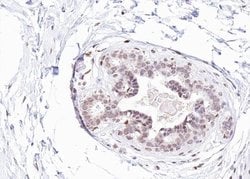 Invitrogen Phospho-Estrogen Receptor alpha (Tyr537) Polyclonal Antibody