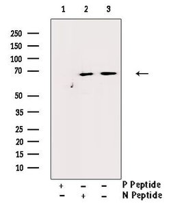 Invitrogen Phospho-Estrogen Receptor alpha (Tyr537) Polyclonal Antibody