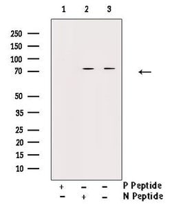 Invitrogen Phospho-C-RAF (Ser296) Polyclonal Antibody 100 &mu;L; Unconjugated:Antibodies,