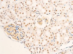 Invitrogen Phospho-Glucocorticoid Receptor (Ser226) Polyclonal Antibody