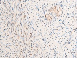 Invitrogen Phospho-Glucocorticoid Receptor (Ser226) Polyclonal Antibody