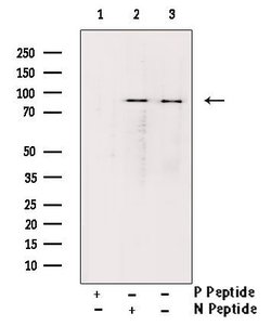Invitrogen Phospho-Glucocorticoid Receptor (Ser226) Polyclonal Antibody