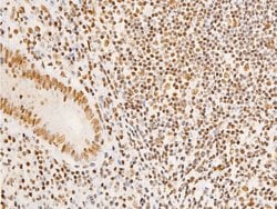 Invitrogen Phospho-Glucocorticoid Receptor (Ser203) Polyclonal Antibody
