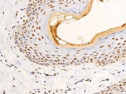 Invitrogen Phospho-Glucocorticoid Receptor (Ser203) Polyclonal Antibody
