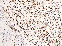 Invitrogen Phospho-Glucocorticoid Receptor (Ser203) Polyclonal Antibody