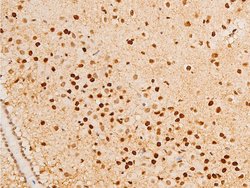 Invitrogen Phospho-Glucocorticoid Receptor (Ser203) Polyclonal Antibody