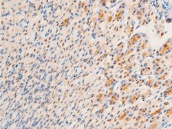 Invitrogen Phospho-Glucocorticoid Receptor (Ser203) Polyclonal Antibody