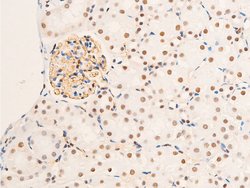 Invitrogen Phospho-Glucocorticoid Receptor (Ser203) Polyclonal Antibody