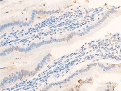 Invitrogen Phospho-Glucocorticoid Receptor (Ser203) Polyclonal Antibody