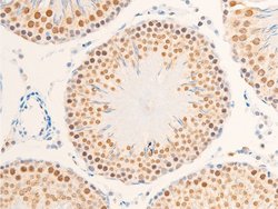 Invitrogen Phospho-Glucocorticoid Receptor (Ser203) Polyclonal Antibody