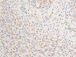 Invitrogen Phospho-Glucocorticoid Receptor (Ser203) Polyclonal Antibody