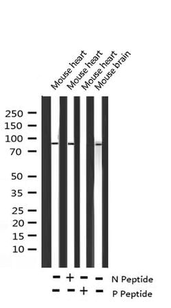 Invitrogen Phospho-Glucocorticoid Receptor (Ser203) Polyclonal Antibody