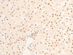 Invitrogen Phospho-TK1 (Ser13) Polyclonal Antibody 100 &mu;L; Unconjugated:Antibodies,