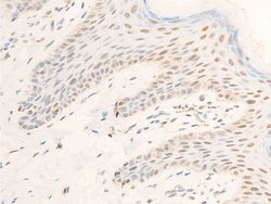 Invitrogen Phospho-TK1 (Ser13) Polyclonal Antibody 100 &mu;L; Unconjugated:Antibodies,