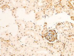 Invitrogen Phospho-TK1 (Ser13) Polyclonal Antibody 100 &mu;L; Unconjugated:Antibodies,
