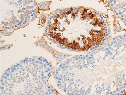 Invitrogen Phospho-TK1 (Ser13) Polyclonal Antibody 100 &mu;L; Unconjugated:Antibodies,