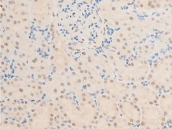Invitrogen Phospho-TK1 (Ser13) Polyclonal Antibody 100 &mu;L; Unconjugated:Antibodies,