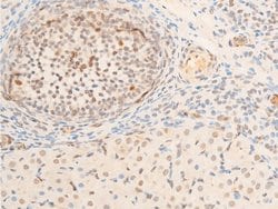 Invitrogen Phospho-TK1 (Ser13) Polyclonal Antibody 100 &mu;L; Unconjugated:Antibodies,