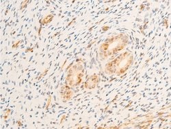 Invitrogen Phospho-TK1 (Ser13) Polyclonal Antibody 100 &mu;L; Unconjugated:Antibodies,