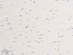 Invitrogen Phospho-ErbB2 (HER-2) (Tyr877) Polyclonal Antibody 100 &mu;L;