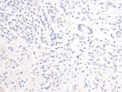 Invitrogen Phospho-ErbB2 (HER-2) (Tyr877) Polyclonal Antibody 100 &mu;L;