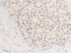 Invitrogen Phospho-ErbB2 (HER-2) (Tyr877) Polyclonal Antibody 100 &mu;L;