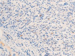 Invitrogen Phospho-ErbB2 (HER-2) (Tyr877) Polyclonal Antibody 100 &mu;L;