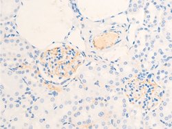 Invitrogen Phospho-ErbB2 (HER-2) (Tyr877) Polyclonal Antibody 100 &mu;L;