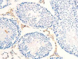 Invitrogen Phospho-ErbB2 (HER-2) (Tyr877) Polyclonal Antibody 100 &mu;L;