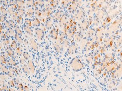 Invitrogen Phospho-ErbB2 (HER-2) (Tyr877) Polyclonal Antibody 100 &mu;L;