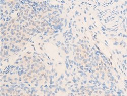 Invitrogen Phospho-ErbB2 (HER-2) (Tyr877) Polyclonal Antibody 100 &mu;L;