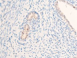 Invitrogen Phospho-ErbB2 (HER-2) (Tyr877) Polyclonal Antibody 100 &mu;L;
